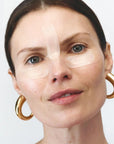 Self-Dissolving Microneedle Patches